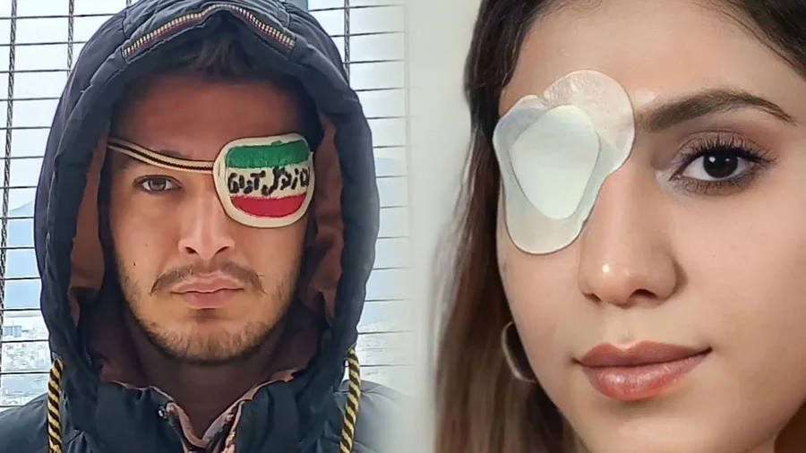 Pse snajper&euml;t n&euml; Iran synojn&euml; fytyrat dhe organet gj*nitale