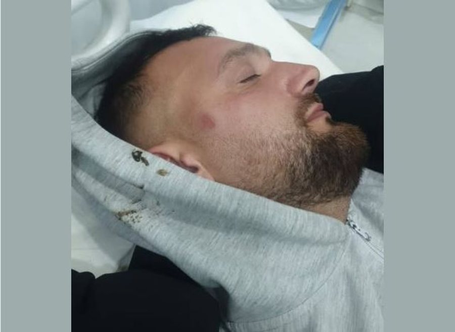 'Pasi m&euml; dhunuan m&euml; than&euml; ik n&euml; spital se nuk je