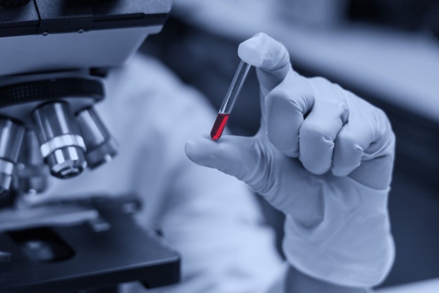 &Ccedil;far&euml; &euml;sht&euml; "gjaku i art&euml;" q&euml; rrjedh