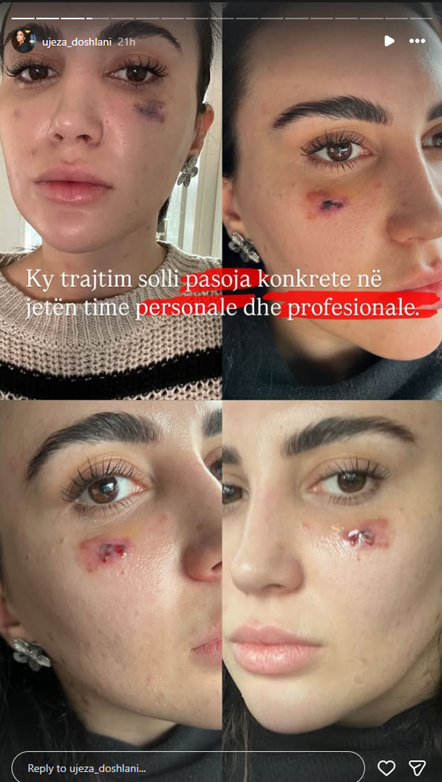 FOTOT/ "D&euml;m i p&euml;rjetsh&euml;m n&euml; fytyr&euml;",