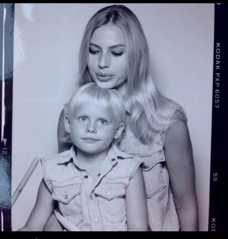 Historia e modeles Lauren Wasser: Shoku toksik nga tamponi, amputimi dhe