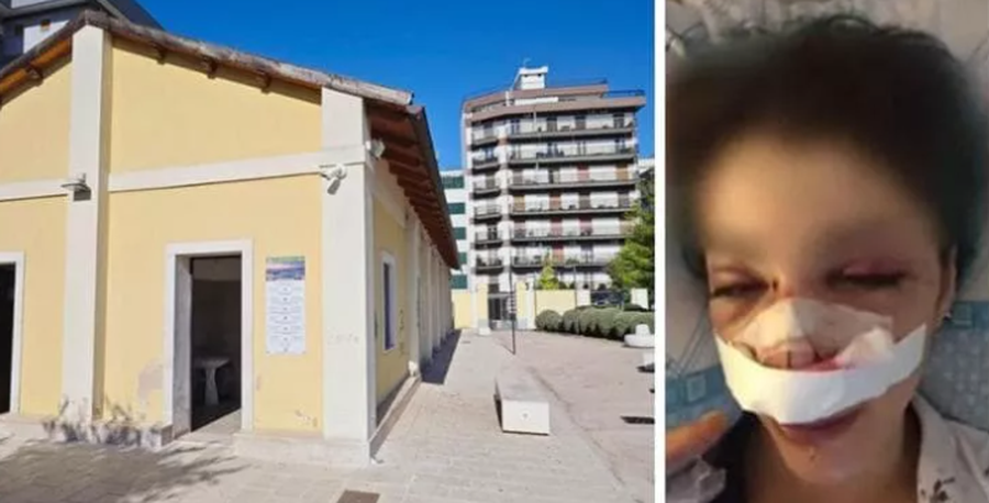 Kërkoi të përdorte tualetin në park, rrihet brutalisht