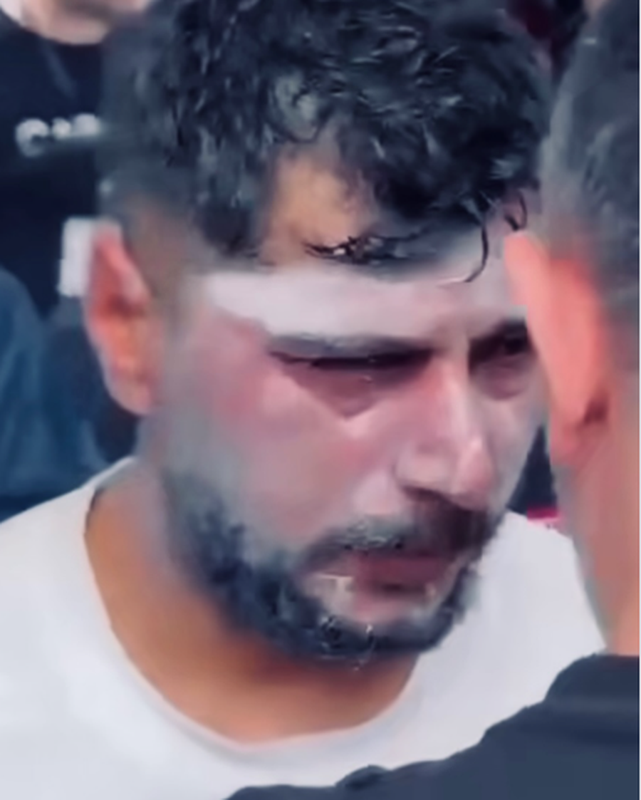 EMRI/ U dhunua n&euml; protest&euml;n para Kuvendit, Marin Mema dhe Aurela