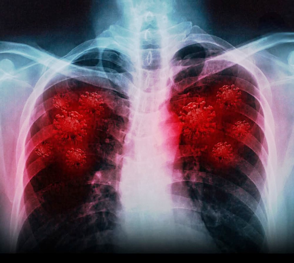 Long Covid/ Scientists have discovered viral fragments hidden in blood