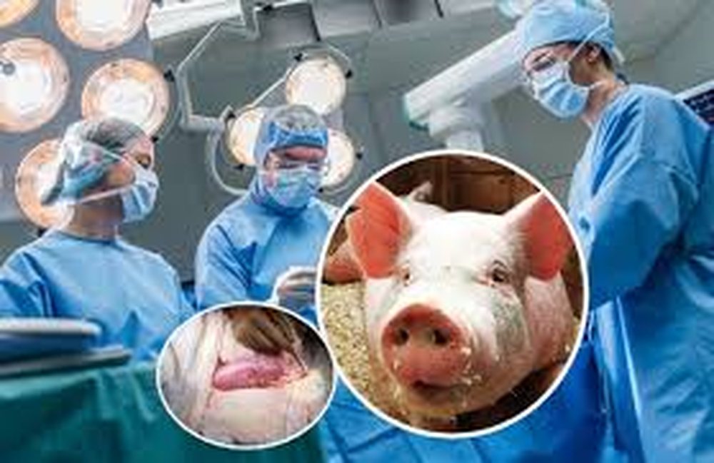 Revolution in medicine: Pig lungs transplanted into humans for the first time!