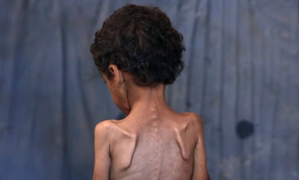 Save the Children: Fëmijët e uritur në Gaza nuk kanë
