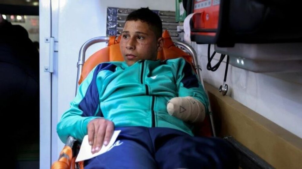 Lufta 2-vjeçare në Gaza ka bërë që 21 mijë
