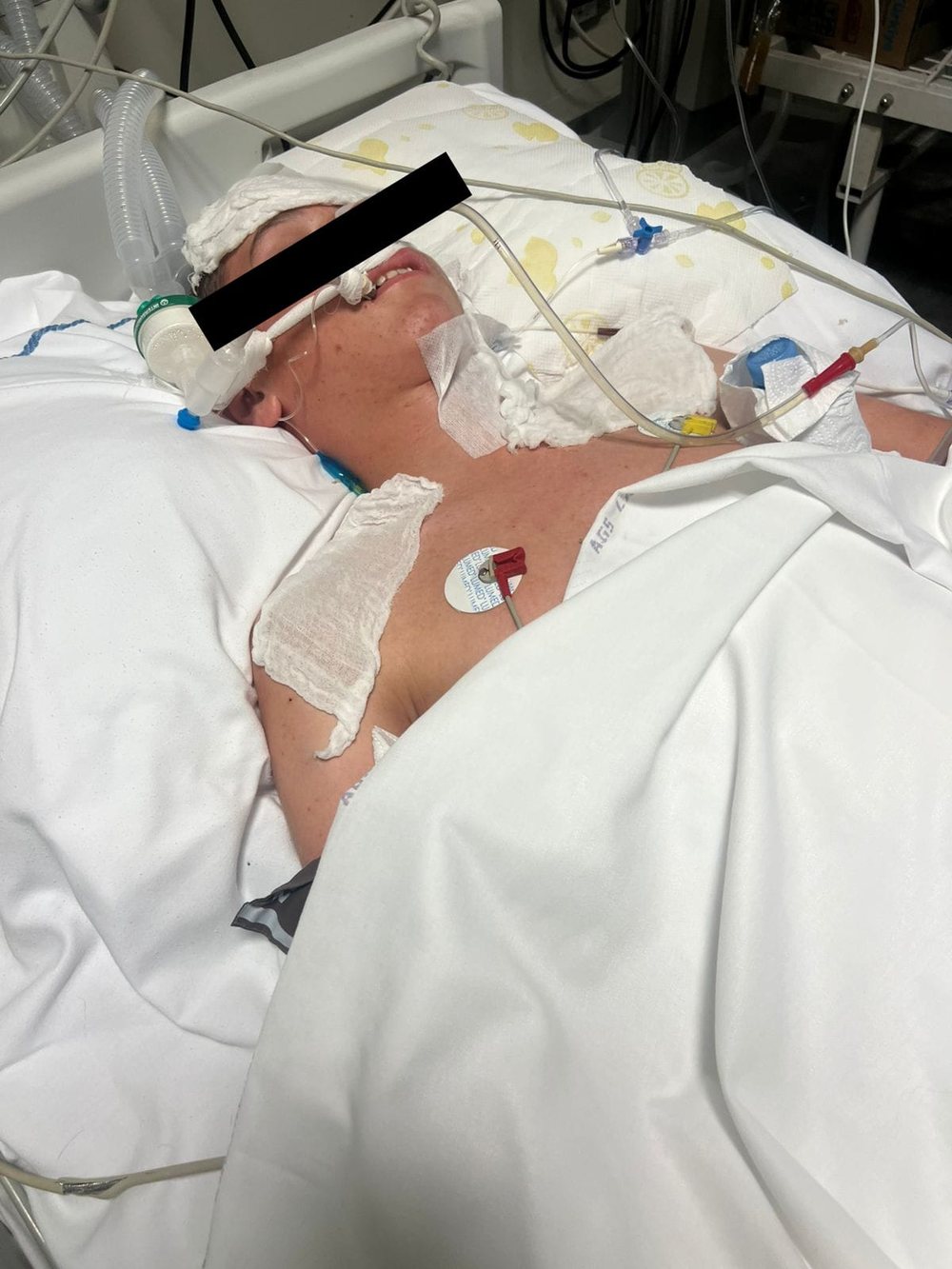 15-year-old boy dies in Durrës, beaten by peer after swearing on Tik Tok