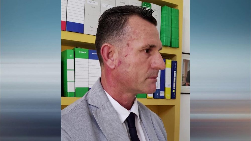 Sherr n&euml; pik&euml; karburanti n&euml; Vlor&euml;, dhunohet avokati i Ilir