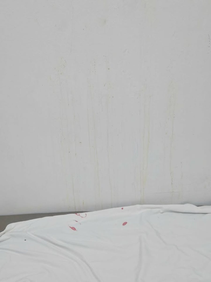 Njolla gjaku n&euml; &ccedil;ar&ccedil;af, gjendja e higjien&euml;s n&euml;