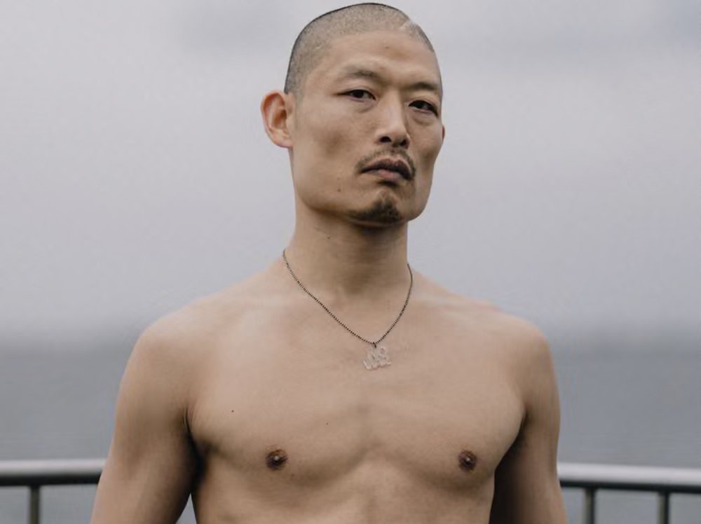 DJ japonez mposht tumorin n&euml; tru dhe kthehet n&euml; simbol t&euml; paqes