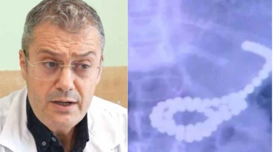 Vajza 3-vjeçare gëlltiti 62 rruaza magnetike, shpëton