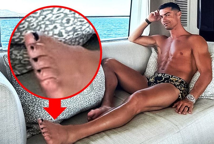 Pse i lyen thonjtë Cristiano Ronaldo?