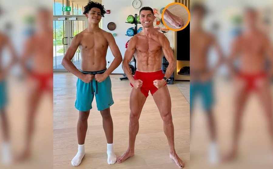 Pse i lyen thonjtë Cristiano Ronaldo?